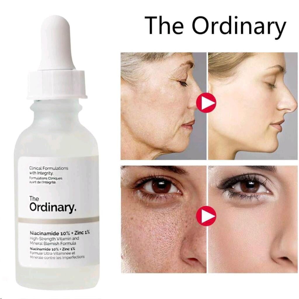 Niacinamide 10% + Zinc 1%
